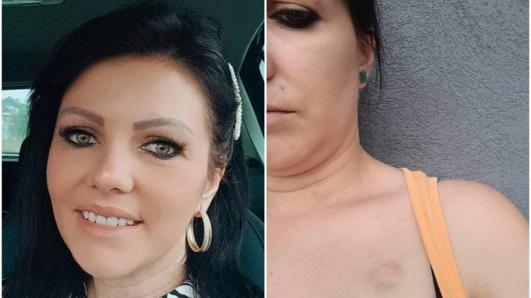 MIRELU IZ SARAJEVA PRETUKLI SVEKAR I SVEKRVA: BILA SAM SVA KRVAVA, TUKLI SU ME I PRED POLICIJOM