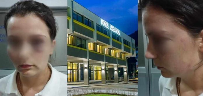 Tuzna Bh Realnost Istog Dana Radnica Pustena Iz Bolnice I