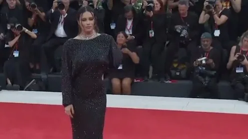 Lima plijenila svojom ljepotom iako joj neki poručuju da ‘ne izgleda lijepo kao prije’