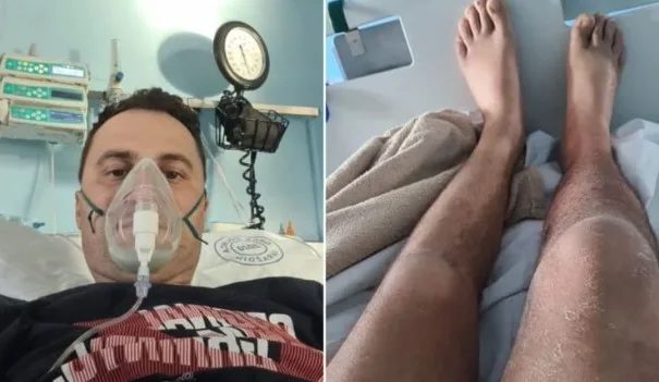 Probudio se i nije mogao hodati, a onda je započela njegova borba za život: “Razmišljao sam hoću li se sutra probuditi”