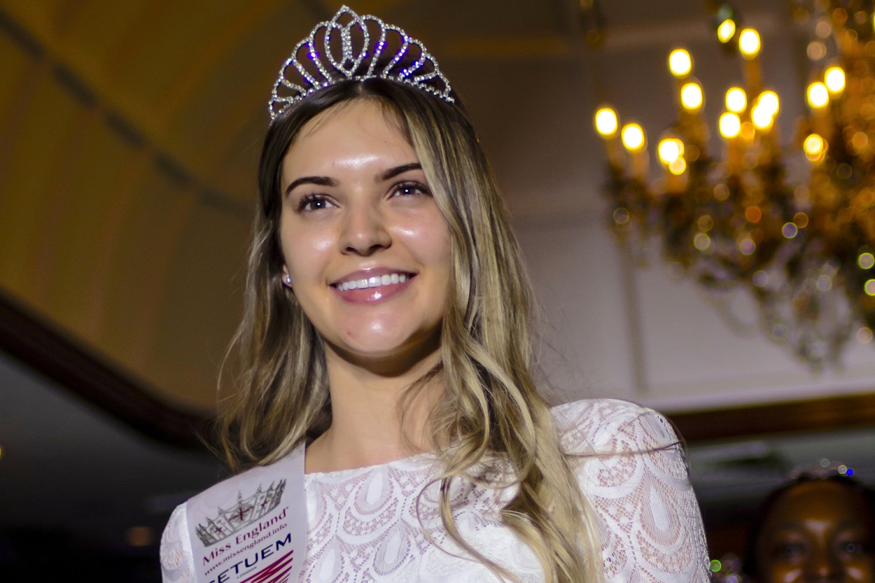 Održan prvi svjetski izbor za Miss bez šminke: pobijedila je 26-godišnja Nataša