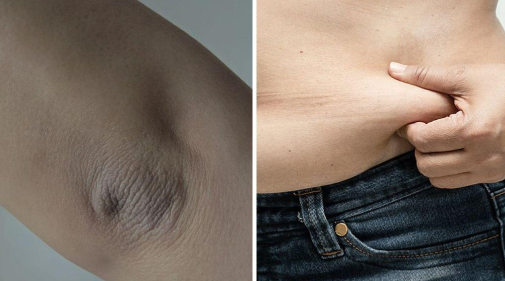 30% LJUDI IMA OVAJ SMRTONOSNI POREMEĆAJ, MNOGI NI NE ZNAJU