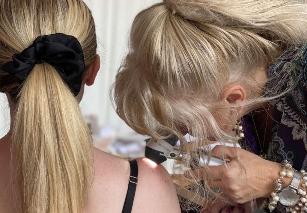 MOŽE ZAHVATITI SVAKOGA, BEZ OBZIRA NA POL, UZRAST ILI RASU! MJESEC BORBE PROTIV MELANOMA