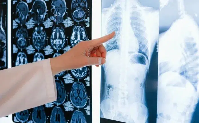 1744645835 Oprez Ovako Tijelo Upozorava Da Se Stvara Tromb – Evo.webp