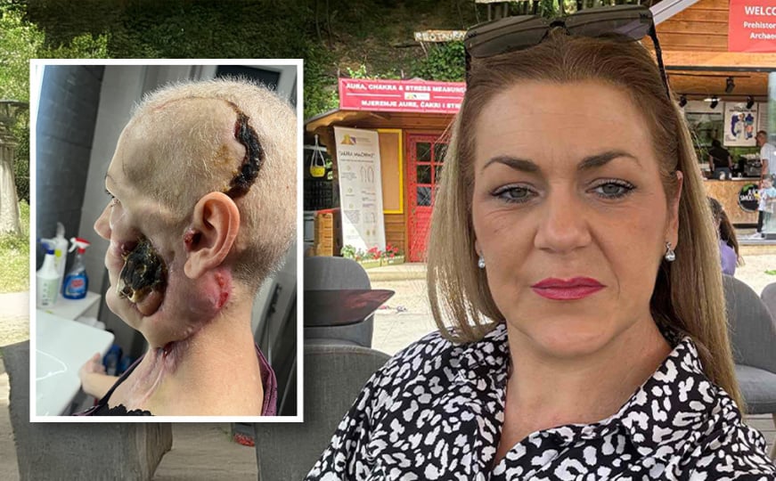 U samo 12 sati prikupljeni novac za liječenje Medisa Delic