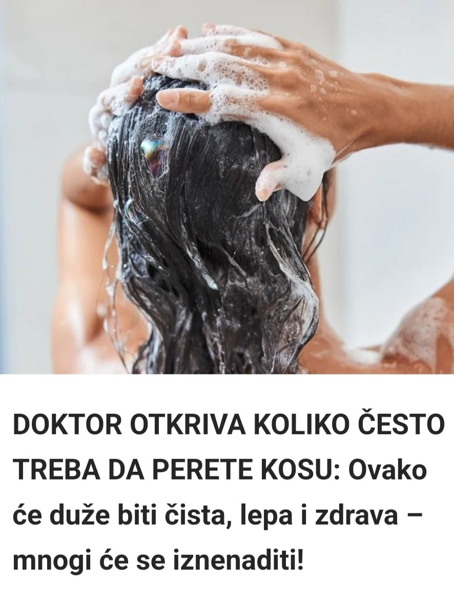 Pogrešno perete kosu cijeli život – doktor objasnio koliko je puta nedeljno dovoljno!