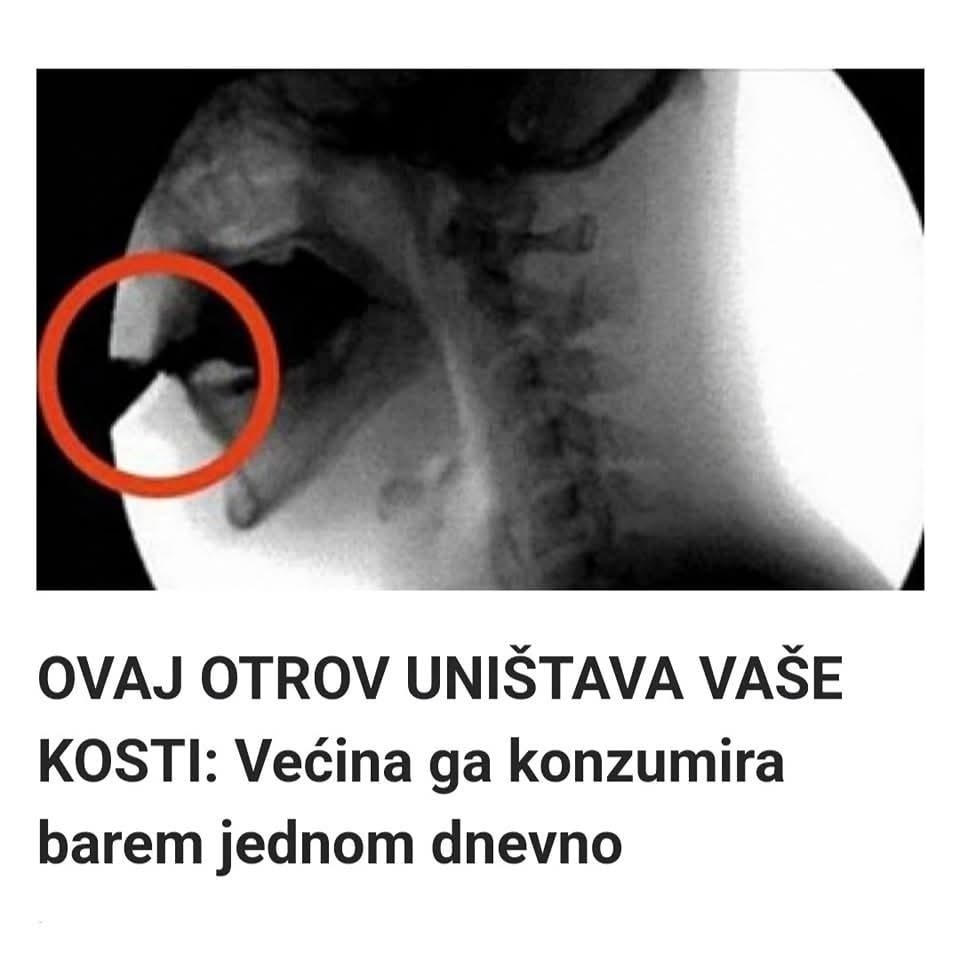 Većina ga konzumira barem jednom dnevno – Evo koja namirnica je otrov za vaše kosti