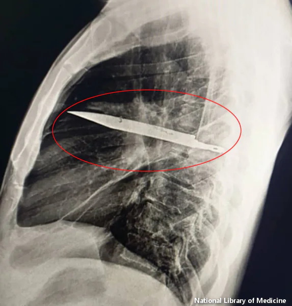 Nož u prsima Tanzanijci