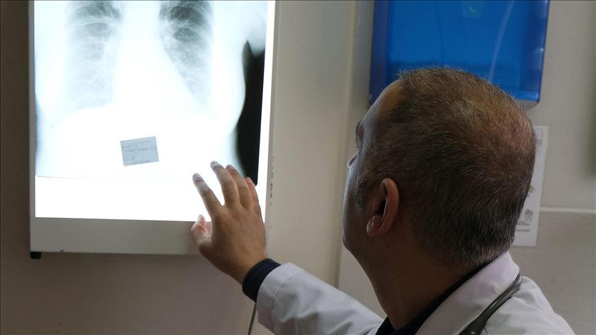 Najsmrtonosniji karcinom sve veća opasnost i u BiH: Blizu dva miliona novih slučajeva godišnje širom svijeta