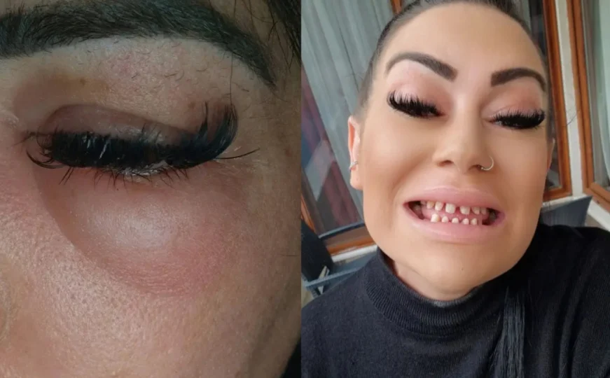 Otišla po nove zube u Tursku a dobila samo probleme: Sada može jesti samo mekanu hranu